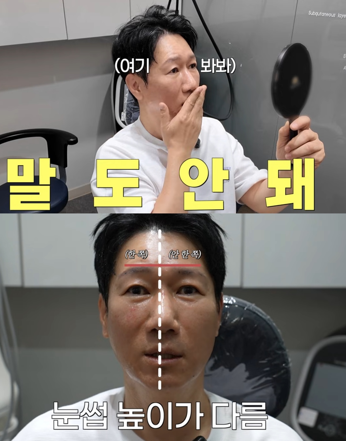 지석진, 리프팅 시술 받고 깜짝…“한쪽만 올라가” 웃음 (지편한세상)