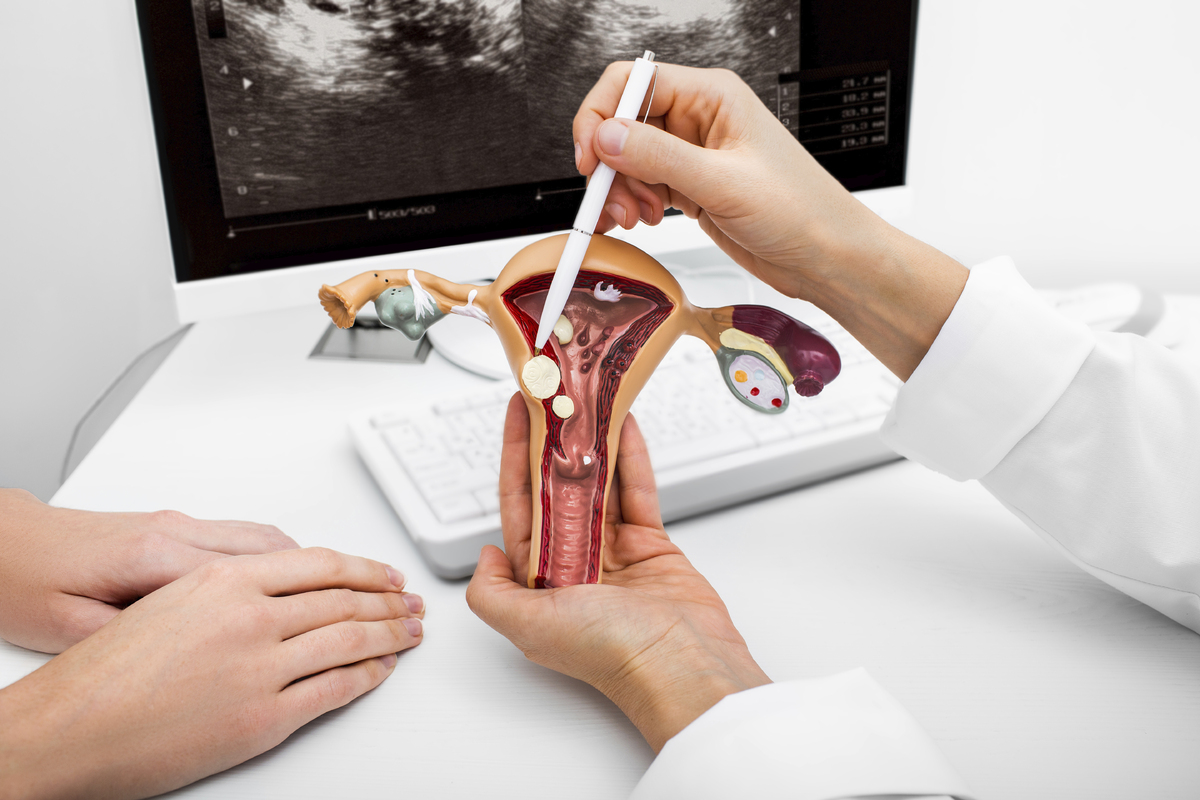 자궁근종 자궁보존 전략…정밀검사와 다학제 협진이 핵심