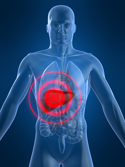 간의날, 간암 일으키는 원인 B형간염... "C형간염이 85% 차지"