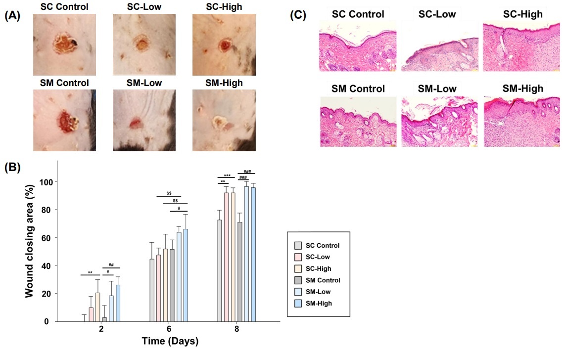 아이디병원-서울대병원 공동연구팀, 엑소좀 활용 상처 재생 효과 입증
