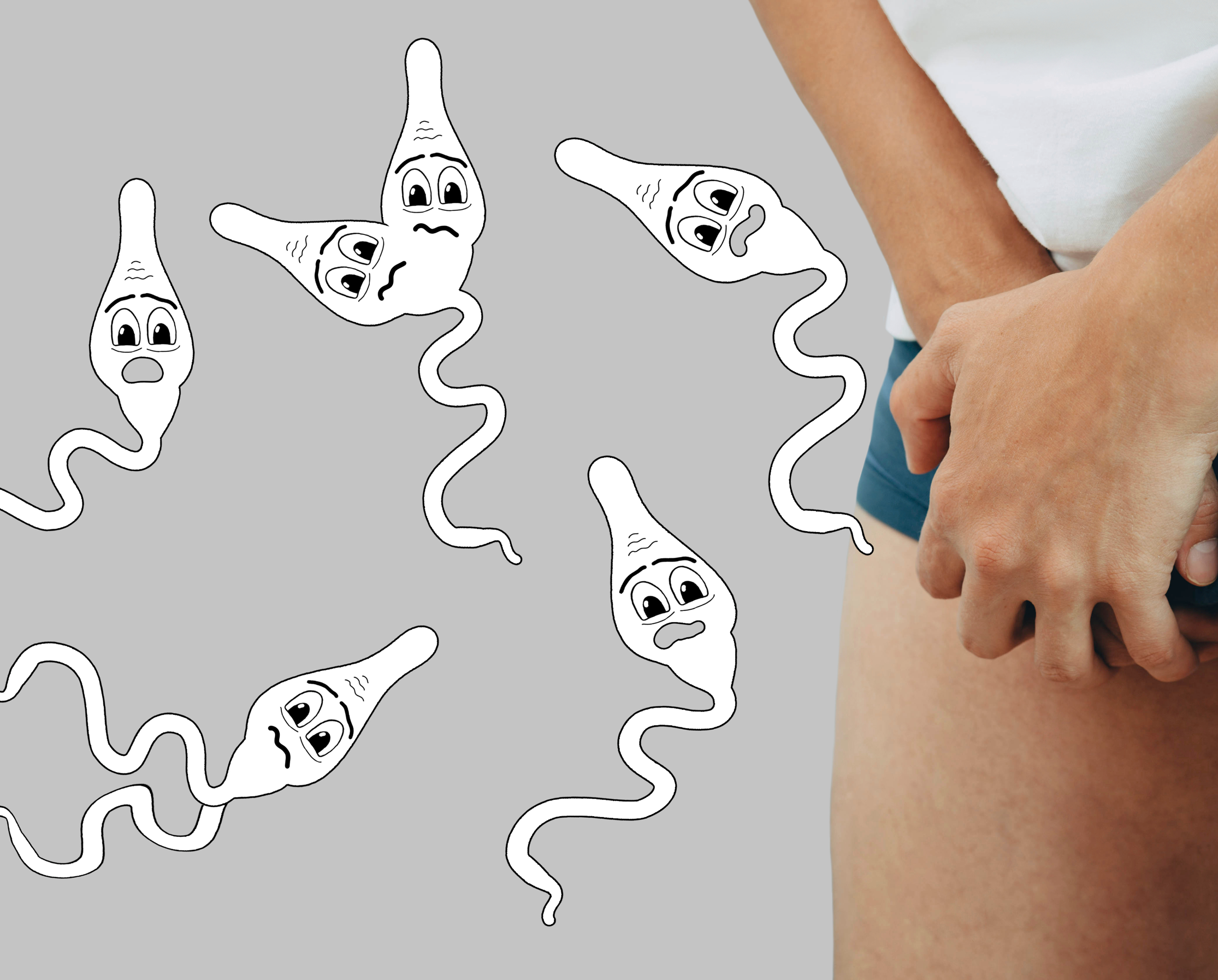 [민트 건강 톡!] 정자활동성 낮추는 정계정맥류, 남성 난임 원인이 이것 때문?