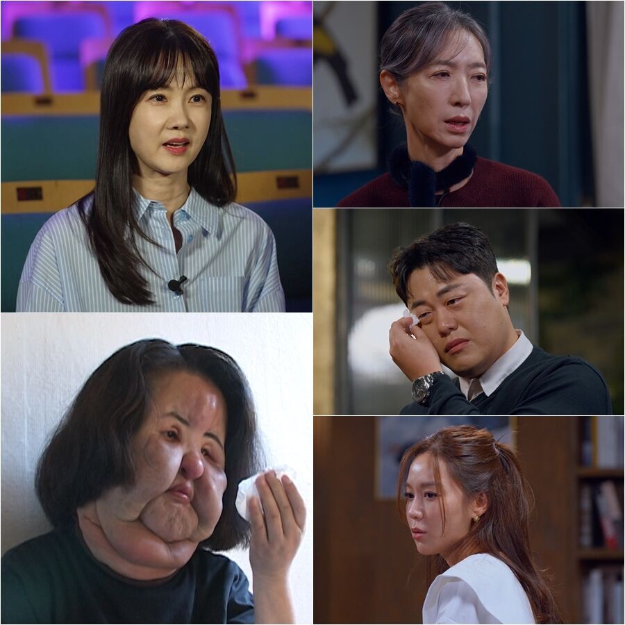 불법 성형과 고통…‘선풍기 아줌마’ 뒤 감춰진 충격 이야기 공개 (꼬꼬무)