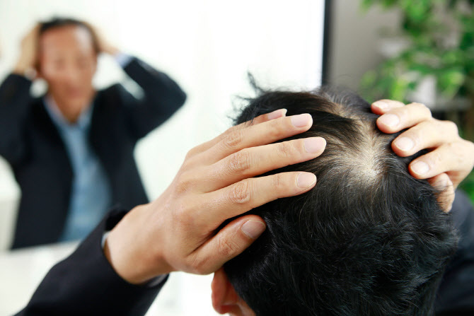 탈모약 급여 논의까지 나온 시대…지방줄기세포 시술이 보조한다?