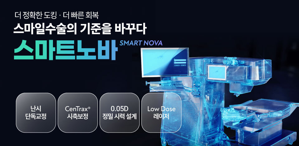 누네안과병원, 최신 시력교정 기술 ‘스마트노바’ 정식 도입